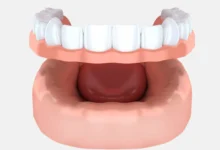 چگونه دندان مصنوعی برای افراد با مشکلات لثه مناسب است؟