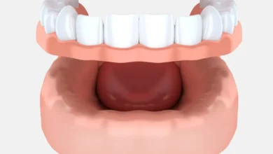 چگونه دندان مصنوعی برای افراد با مشکلات لثه مناسب است؟