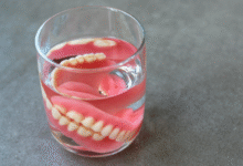 چگونه می توان دندان مصنوعی را از لکه دار شدن جلوگیری کرد؟