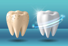 چگونه دندان ها به مرور زمان تغییر می کنند؟