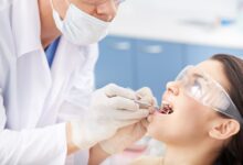 چه مدت پس از بلیچینگ دندان باید برای معاینه به دندان پزشک مراجعه