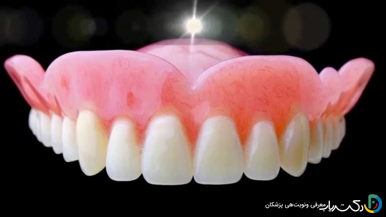 چقدر زمان می برد تا دندان مصنوعی نصب شود؟