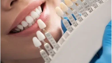چگونه از روکش دندان مراقبت کنیم؟