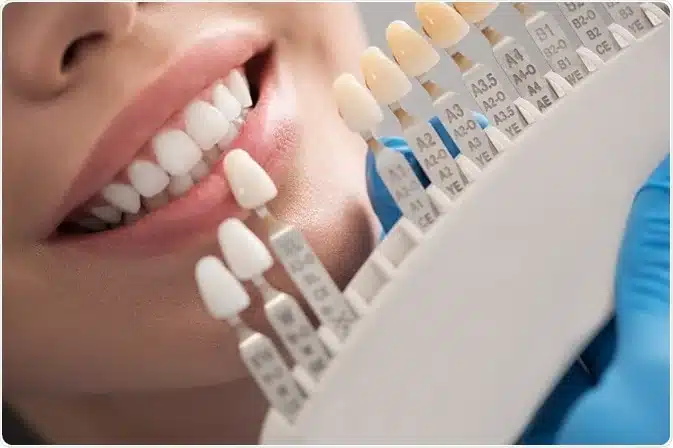 چگونه از روکش دندان مراقبت کنیم؟