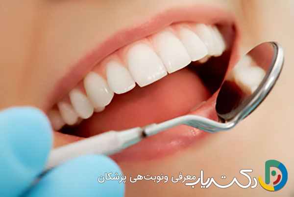 چطور کامپوزیت دندان را تمیز نگه داریم؟