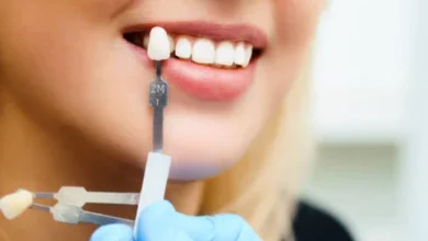 چطور از عوارض جانبی روکش دندان جلوگیری کنیم؟