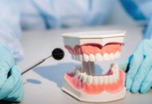 چطور از ترمیم دندان مراقبت کنیم؟