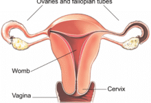 هزینه عمل هیسترکتومی (تعرفه های دولتی و خصوصی)