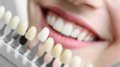 آیا کامپوزیت دندان برای دندان های جلو بهتر است؟