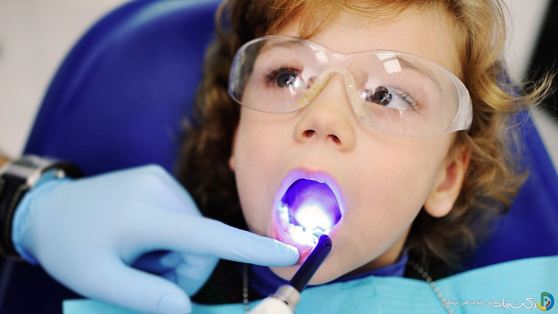 آیا کامپوزیت دندان برای کودکان مناسب است؟