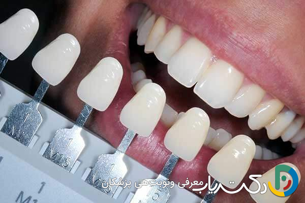 آیا کامپوزیت دندان برای دندان های پوسیده مناسب است؟