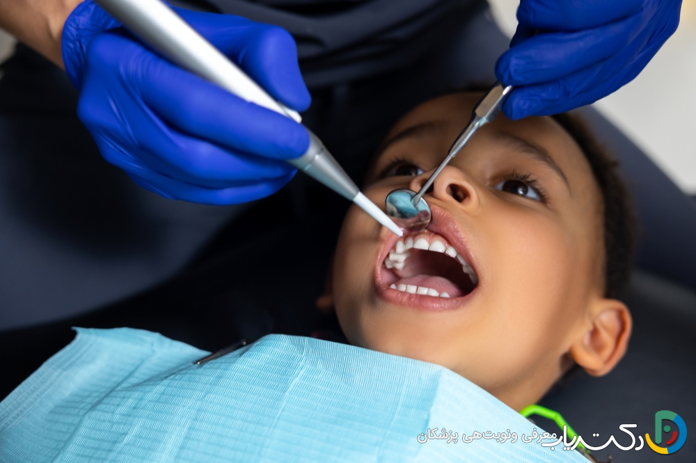 آیا ترمیم دندان برای کودکان مناسب است؟