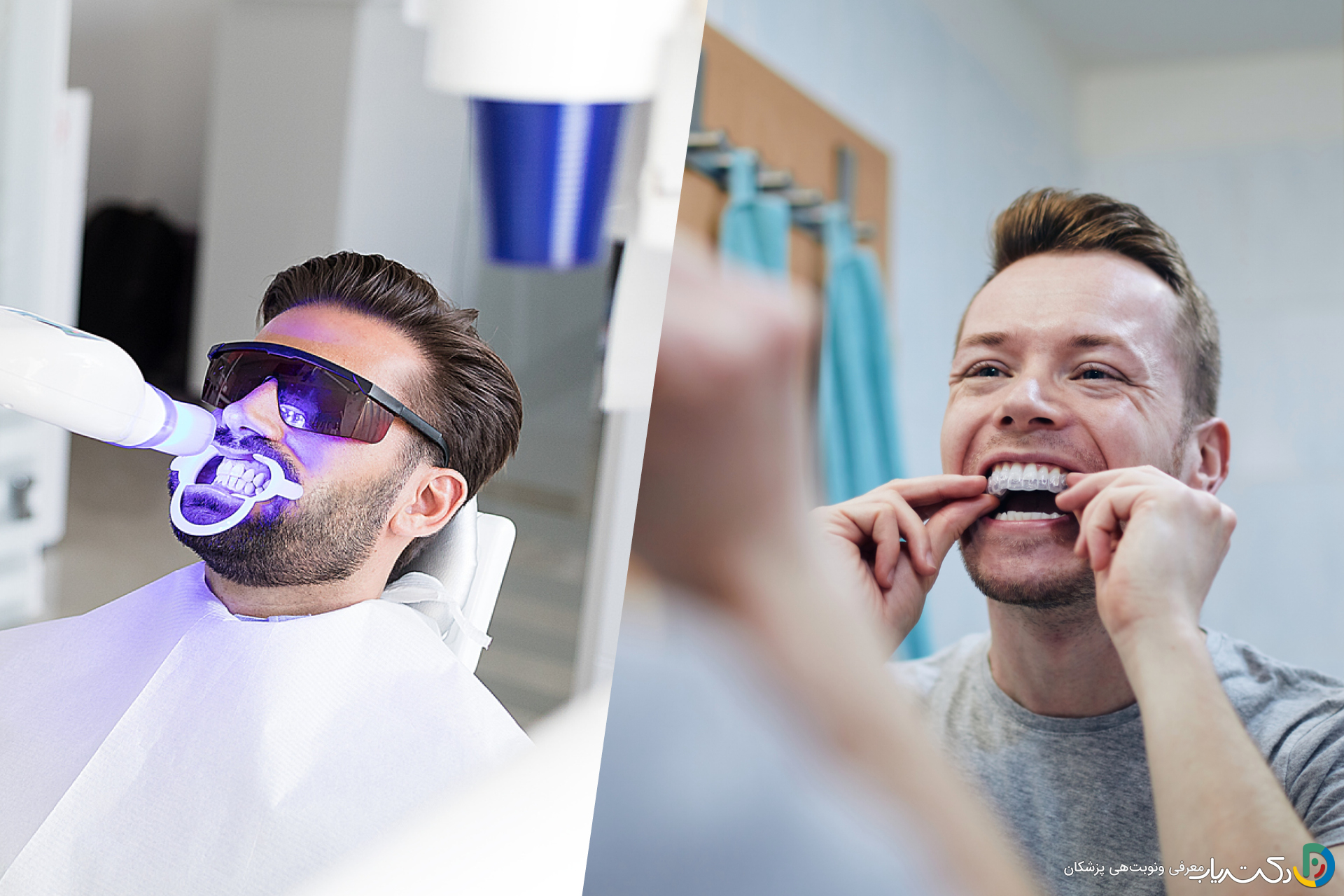 آفیس بلیچینگ موثرتر است یا هوم بلیچینگ؟