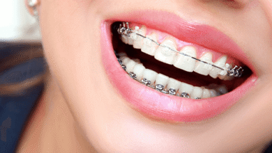 آیا ارتودنسی برای هر فرد به یک اندازه هزینه بر است؟