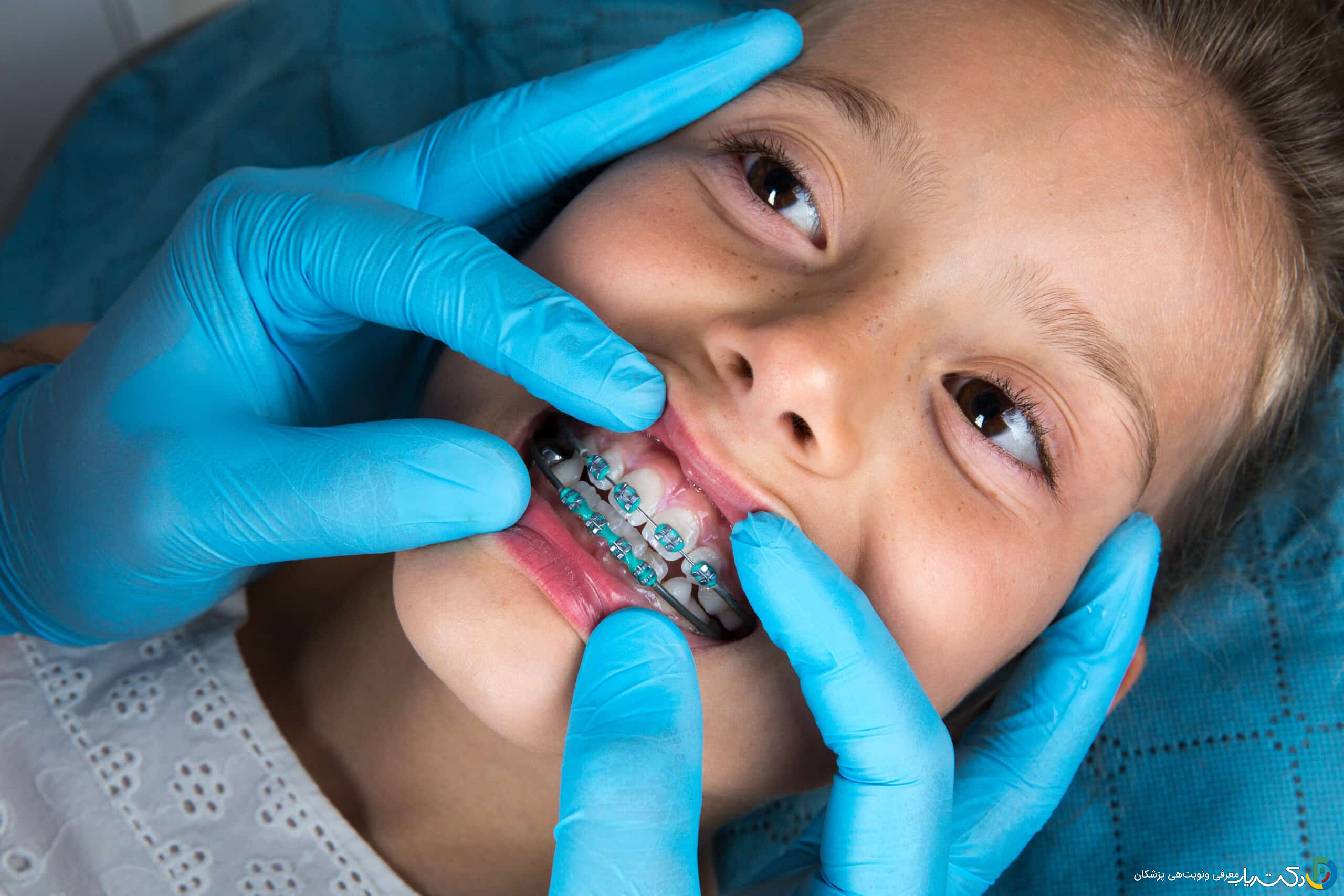 آیا ارتودنسی برای کودکان مناسب است؟