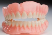 آیا برای نصب دندان مصنوعی نیاز به جراحی است؟