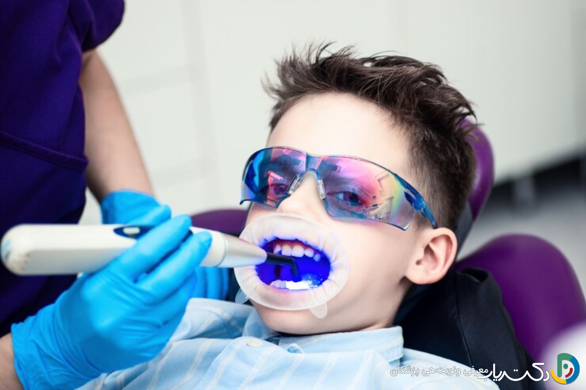 آیا بلیچینگ دندان برای کودکان مناسب است؟