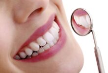 آیا بلیچینگ دندان برای همه افراد مناسب است؟