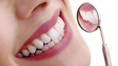 آیا بلیچینگ دندان برای همه افراد مناسب است؟