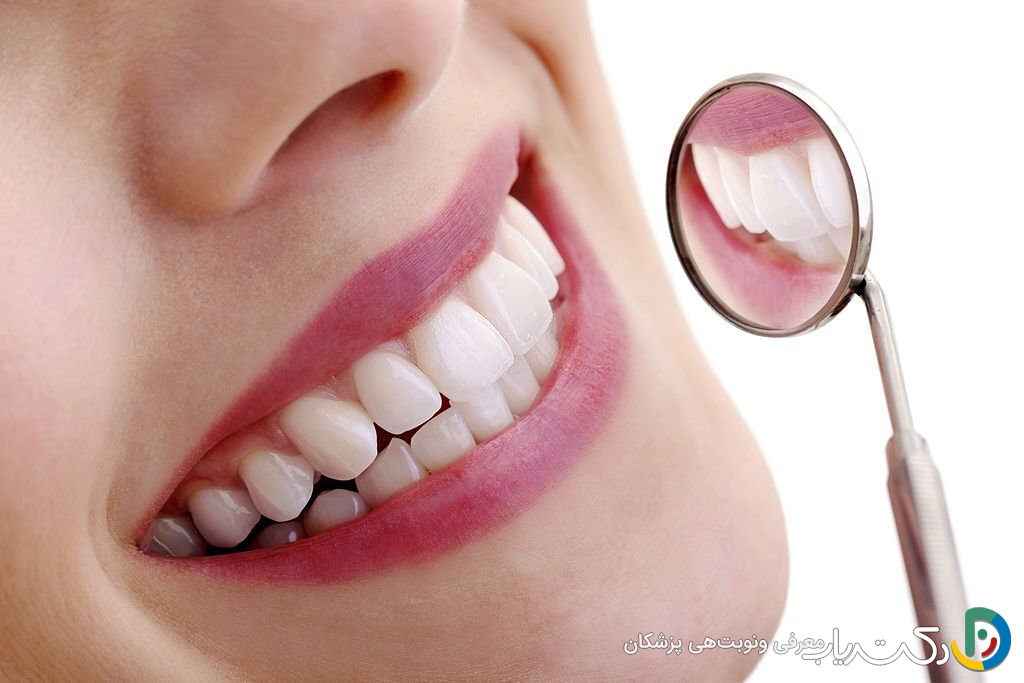 آیا بلیچینگ دندان برای همه افراد مناسب است؟