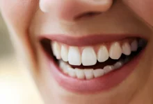آیا بلیچینگ دندان برای افرادی که دندان های حساس دارند مناسب است؟
