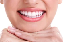 آیا بلیچینگ دندان برای زنان باردار مناسب است؟
