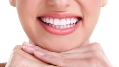 آیا بلیچینگ دندان برای زنان باردار مناسب است؟