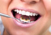 ارتودنسی لینگوال یا ارتودنسی پشت دندانی چیست ؟