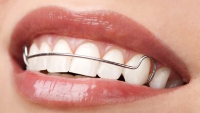 چه اقداماتی باید برای حفظ نتایج ارتودنسی انجام دهیم؟