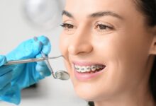 چه خطراتی در طول درمان ارتودنسی وجود دارد؟