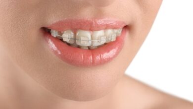 آیا ارتودنسی برای دندان های بزرگتر نیز مناسب است؟