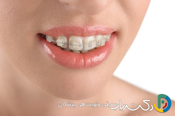 آیا ارتودنسی برای دندان های بزرگتر نیز مناسب است؟