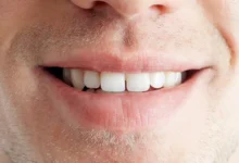 آیا ترمیم دندان دائمی است؟