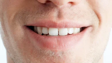 آیا ترمیم دندان دائمی است؟