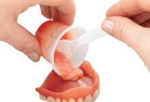آستر کردن یا ریلاین دندان مصنوعی چیست و چه زمانی لازم است؟