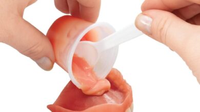 آستر کردن یا ریلاین دندان مصنوعی چیست و چه زمانی لازم است؟