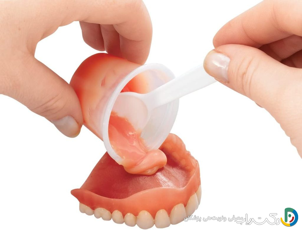 آستر کردن یا ریلاین دندان مصنوعی چیست و چه زمانی لازم است؟