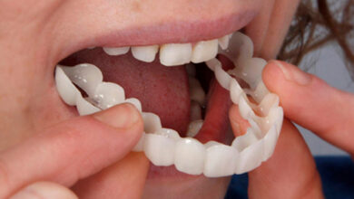 لمینت متحرک دندان چیست ؟ (مزایا و معایت آن)