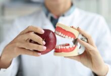 آیا باید از مواد غذایی خاصی بعد از نصب دندان مصنوعی اجتناب کنیم؟