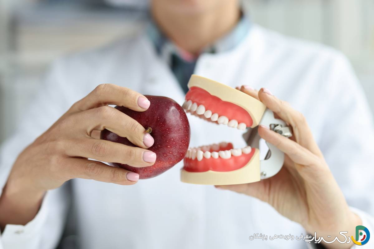 آیا باید از مواد غذایی خاصی بعد از نصب دندان مصنوعی اجتناب کنیم؟