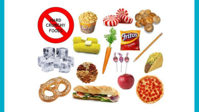 آیا باید از مواد غذایی خاصی بعد از ارتودنسی پرهیز کنیم؟