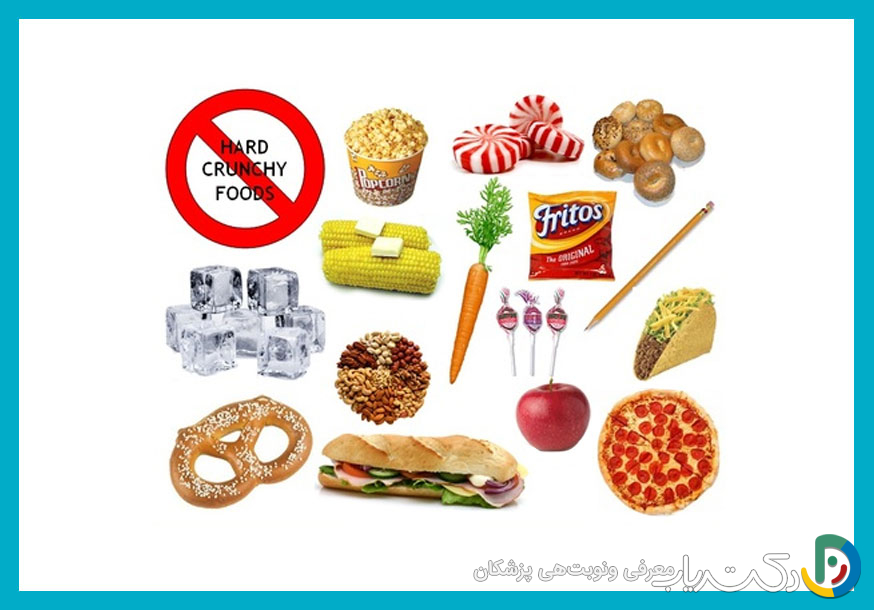 آیا باید از مواد غذایی خاصی بعد از ارتودنسی پرهیز کنیم؟