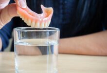 آیا باید دندان مصنوعی را در شب از دهان خارج کنیم؟