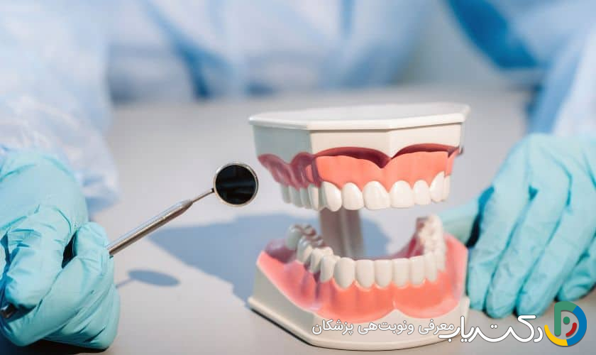 مراقبتهای خاص بعد از ترمیم دندان