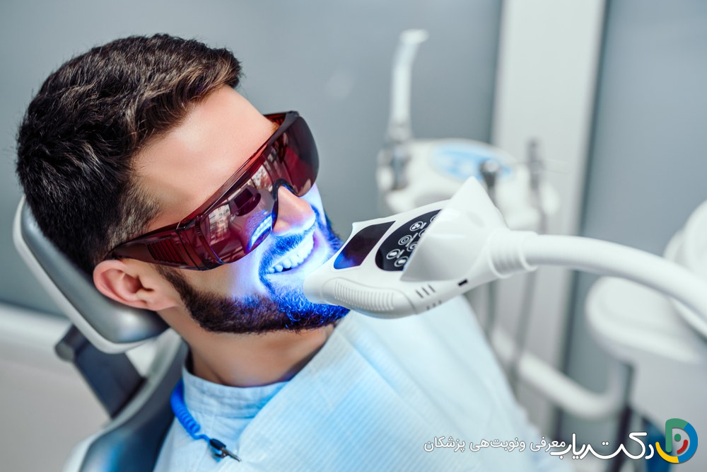 قیمت بلیچینگ دندان (جدول هزینه 1404)