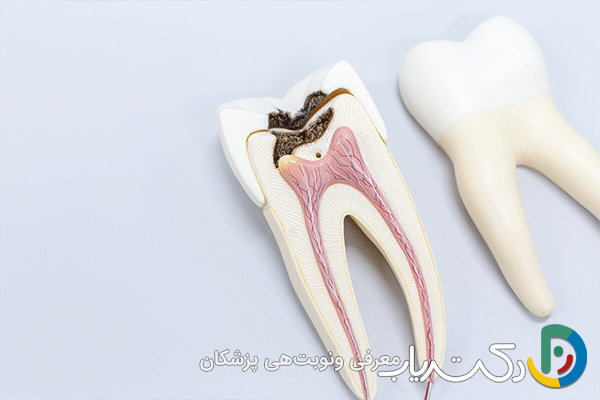 آیا پس از عصب کشی باید از فعالیت های خاصی اجتناب کرد؟