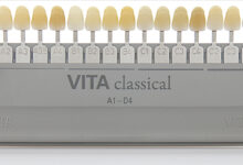 انواع رنگ های کامپوزیت دندان A1, B1, BL