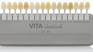 انواع رنگ های کامپوزیت دندان A1, B1, BL