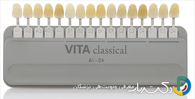 انواع رنگ های کامپوزیت دندان A1, B1, BL