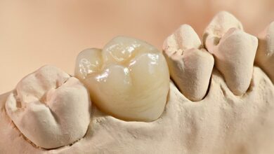 روکش دندان چه مزایایی دارد؟